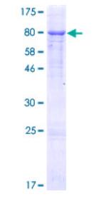 SDS-PAGE (GGT1-4876H).jpg